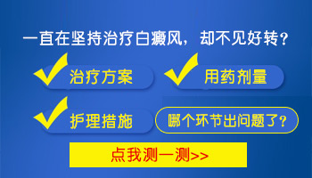 靠喝中药能治好白癜风吗 什么药物对身体没伤害