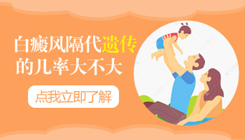 孩子姥爷有白癜风会隔代遗传吗