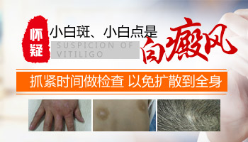 腰部受伤部位好转后发白是不是白癜风