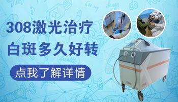 身上白癜风做了激光多长时间可以洗澡