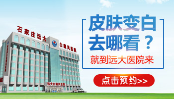 身上白癜风做了激光多长时间可以洗澡