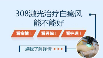 白癜风照激光多久照一次好的快