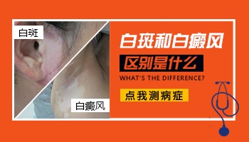 白斑和白癜风的区别 别再傻傻分不清楚