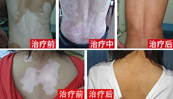 月满中秋, 白白们如何逃过“中秋劫”