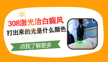 308激光照白癜风的时候激光有颜色么