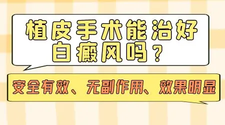 白癜风早期能进行植皮手术吗