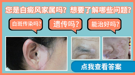 身上为什么长白斑 治的好吗