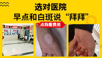 保定白癜风医院怎样 保定治疗白癜风费用贵吗