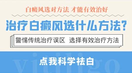 白癜风308激光中医定向和熏蒸做哪个好