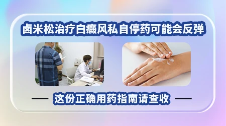 激素药膏停用后白斑反而更严重怎么办