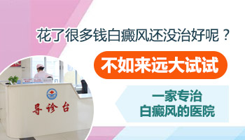 泛发型白癜风能治好吗 怎么治
