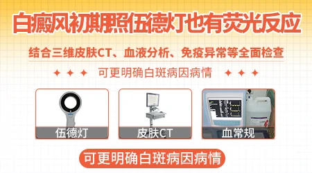 白癜风初期在伍德灯下的状态