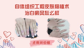 白癜风黑色素细胞种植是取自己身上的黑色素吗