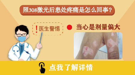 白癜风照了两次光发红有刺痛感是什么原因