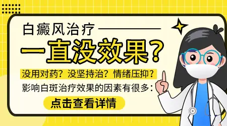 白癜风治疗好久没效果是不是治不好了