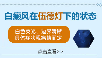 伍德灯下发白的白斑都是白癜风吗