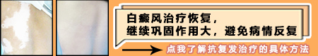 白癜风为什么过段时间又长出新的