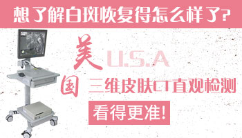 白斑照射激光之后出现一个黑色素点