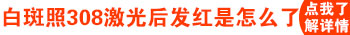 白癜风的位置照光发红好吗