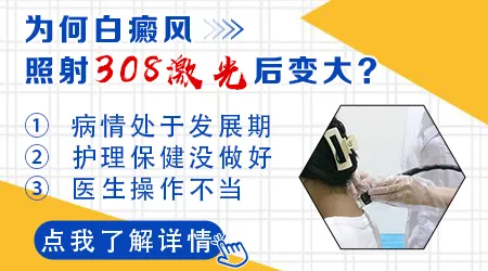 光疗期间白癜风白斑反而变大了是怎么回事