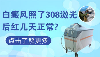 白癜风照308激光照完红几天比较好