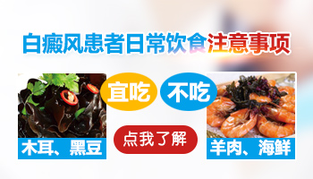白癜风多久复发一次 如何避免白斑复发