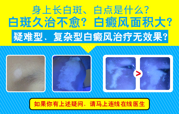 皮肤ct可以检查白癜风吗