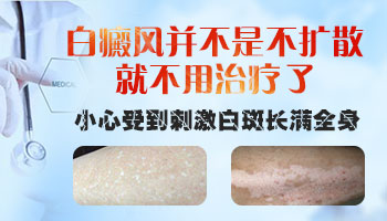 白癜风几十年不扩散还用不用治疗