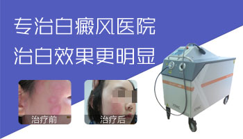 家用白癜风灯会不会伤害眼睛