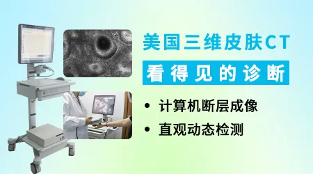 家用几十块的伍德灯查出来的结果靠谱吗