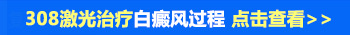 腿上的白斑慢慢变大了是不是白癜风
