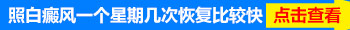 孩子白癜风一个星期照几次308激光好