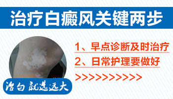 白癜风在伍德灯下是什么样子