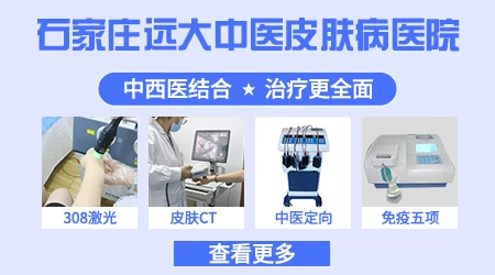 皮肤白斑到医院一般怎么治疗