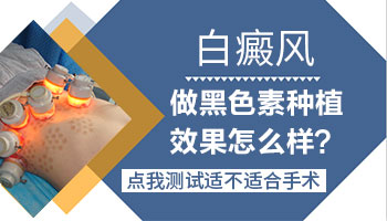 白癜风黑色素细胞移植手术成功率高吗