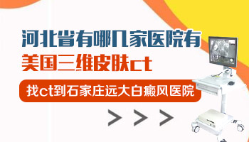 为白斑做一次三维皮肤ct要花费多少钱