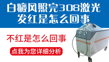 为什么脚上白癜风照308激光这么难红
