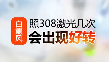 白癜风照308激光多少次可以判定是否有效