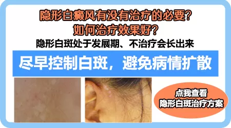 隐形白斑图片大全