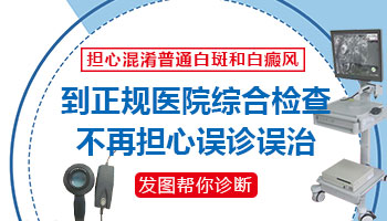 白癜风早期的症状图片有什么特点