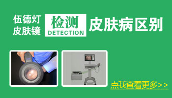 检查白癜风用伍德灯准确还是用皮肤镜