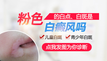 白癜风刚长出来是白色还是粉色