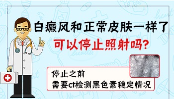 白癜风照射308激光后什么状态下可以停止照射