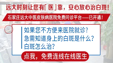石家庄治疗皮肤白斑的医院哪家好