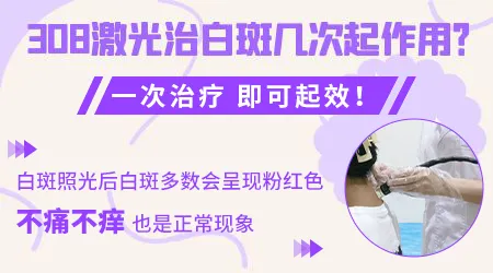 面部白癜风照几次308才能好