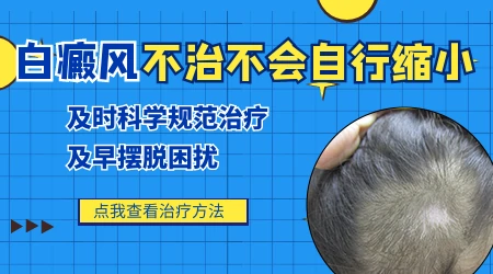 早期白癜风不治疗会发展成什么样图片