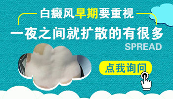 隐私部位白斑如果不治疗会长到其他部位吗