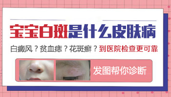 儿子胳膊上有点白是不是得了白癜风