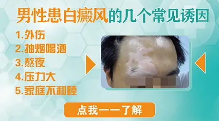 阴茎长白斑是怎么回事