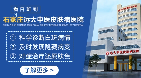 皮肤上出现白斑去石家庄哪个医院治好